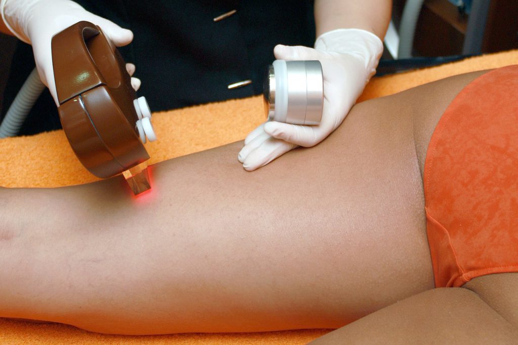 hair removal, beauty, franchise-4188610.jpg